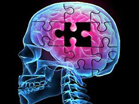 Demens-esoterisk-belyst-15-R-Andrews-Griffiths
